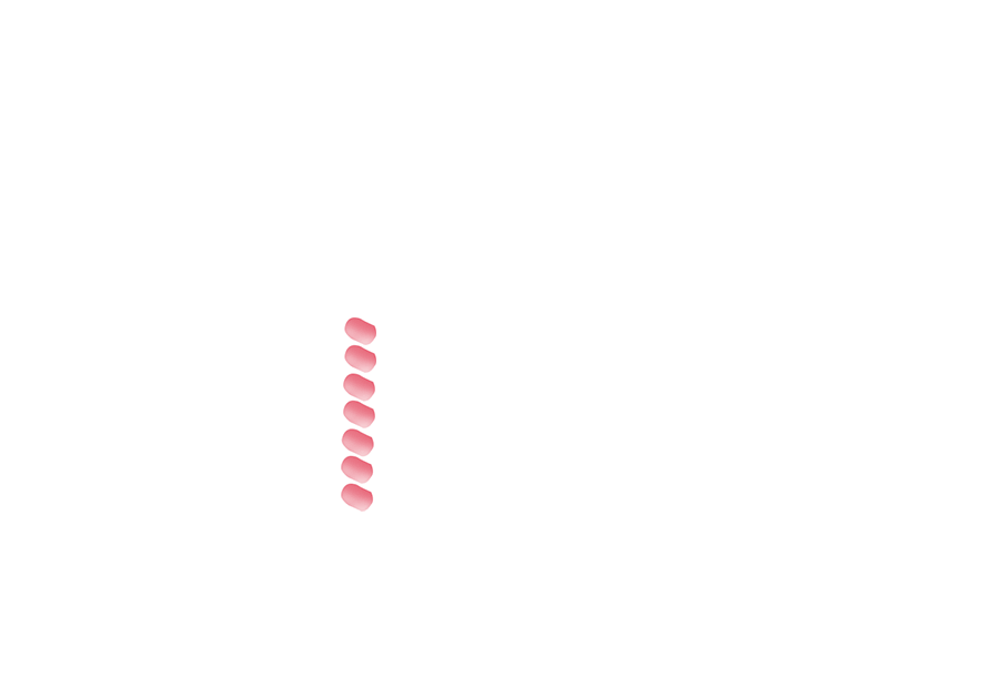 10K Japanese-made black metallic capacitors