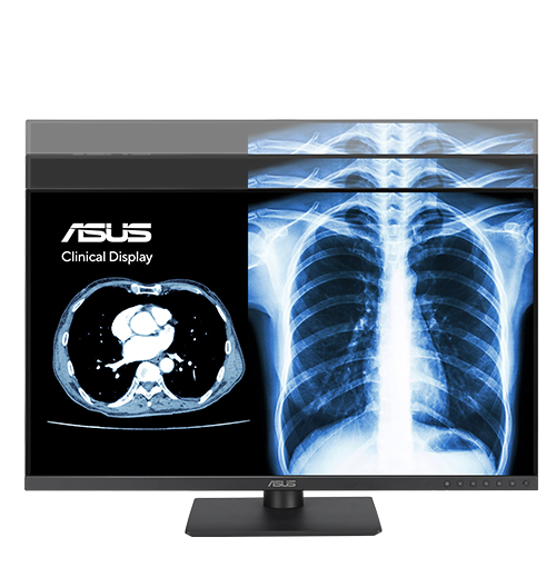 ASUS HealthCare Displays offers height adjustment.