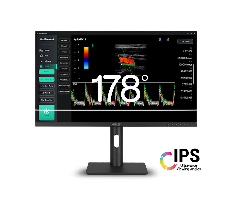 ASUS HealthCare Displays showing 178° wide viewing angles.