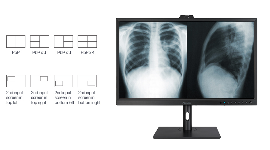 Demonstrate ASUS HealthCare Displays supports PiP/PbP function