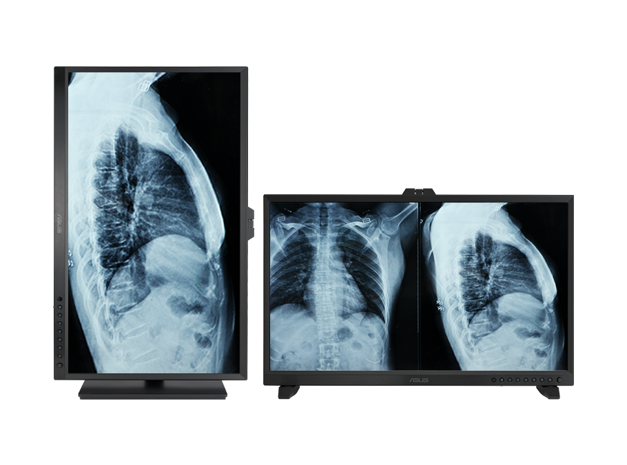 L’écran ASUS HealthCare affiche les nuances de noir les plus profondes possible pour une image extrêmement nette et claire