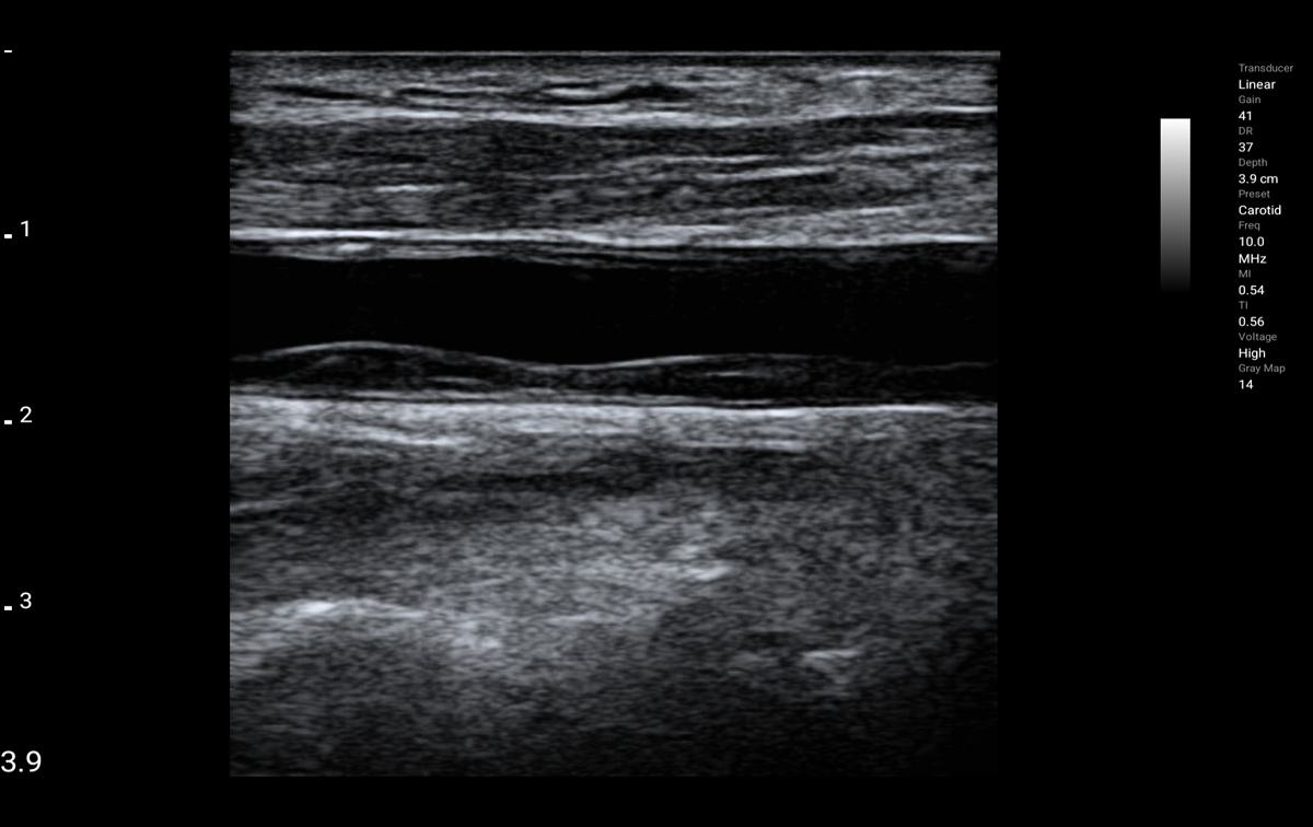 LU800L ultrasound image