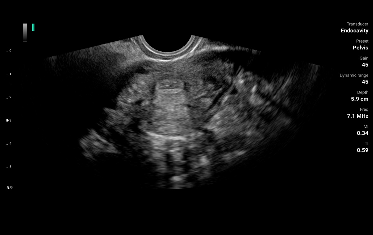 LU800E ultrasound image