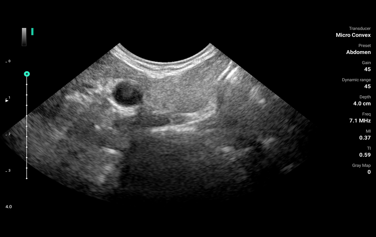 LU800M ultrasound image