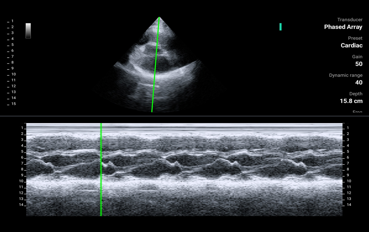 LU800PA ultrasound image