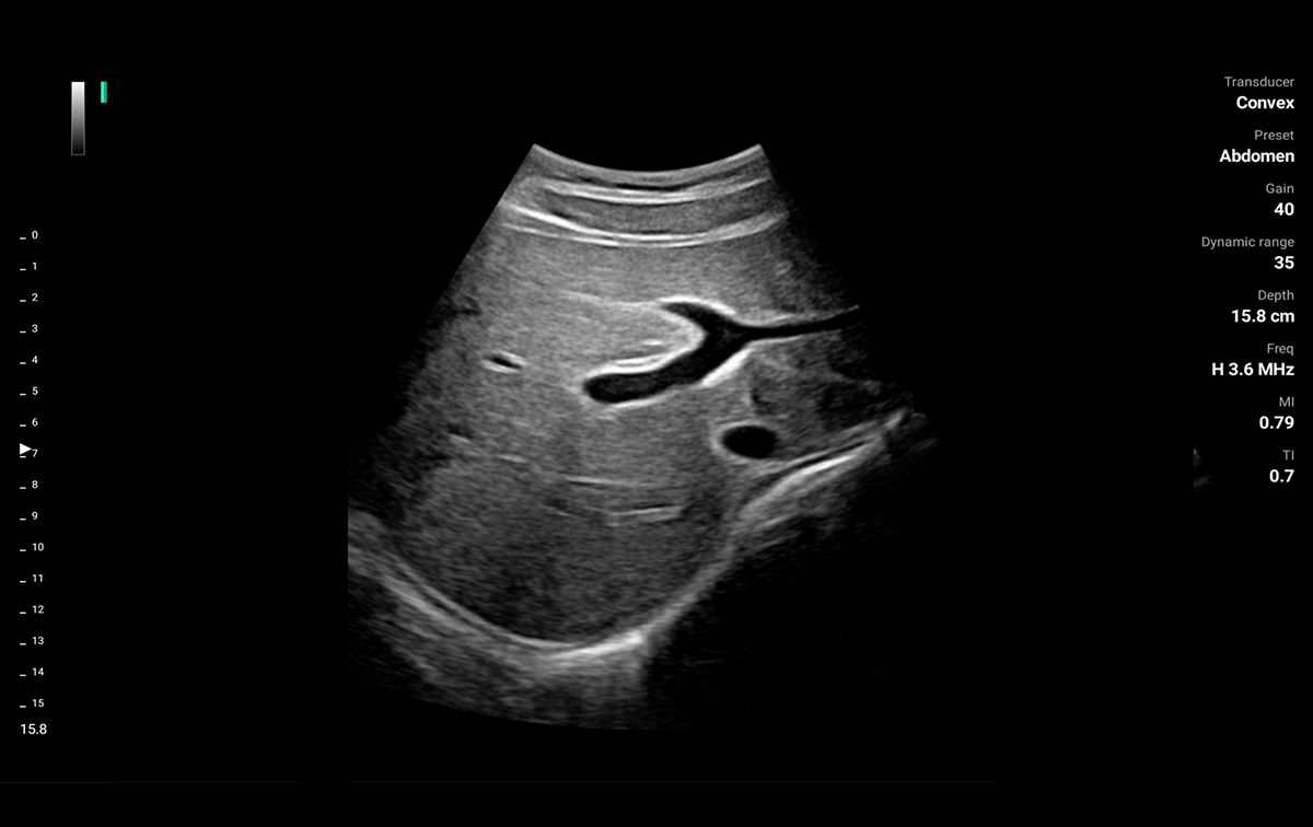 An organ ultrasound image from B mode
