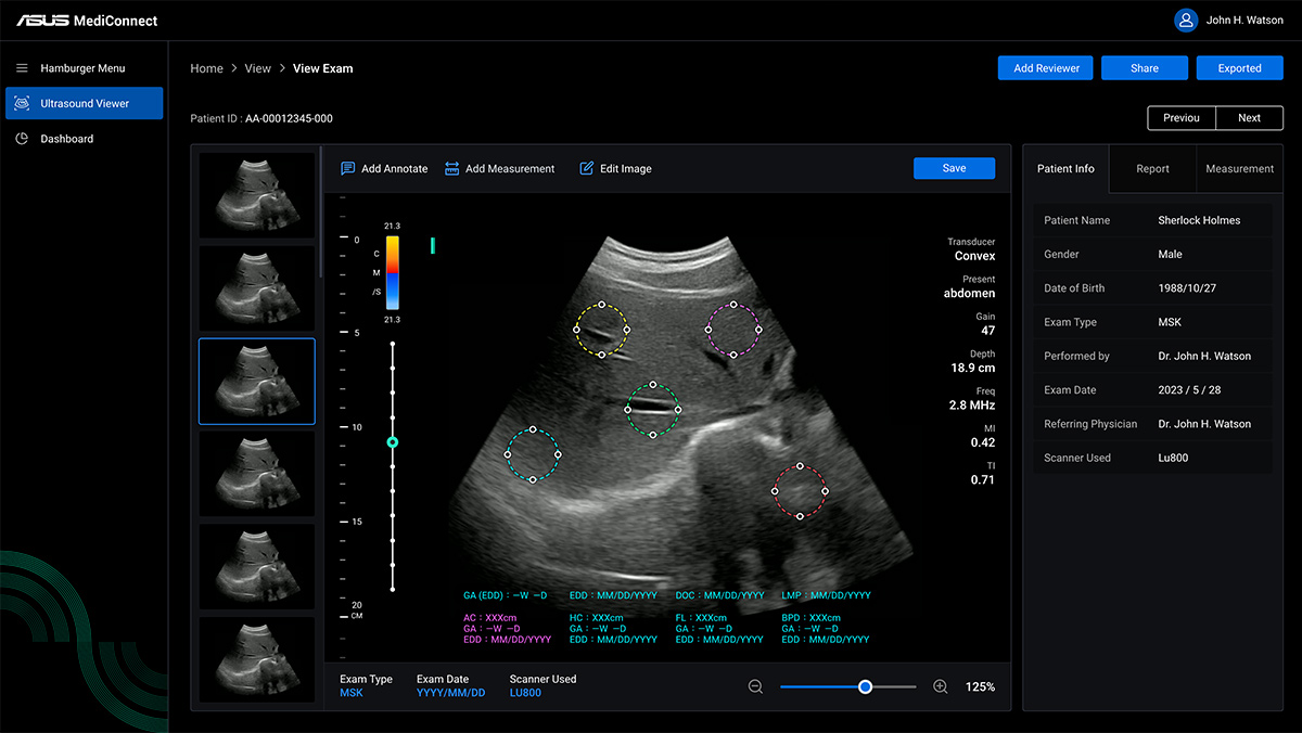 LU800 user interface showing editing on organ ultrasound images