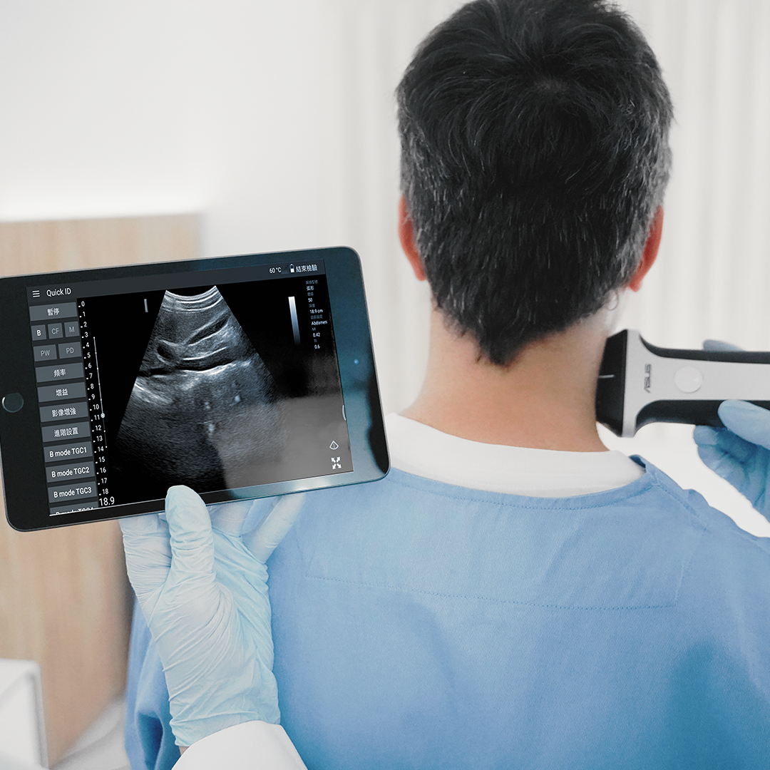 A doctor uses ASUS handheld ultrasound to check patient and shows ultrasound image on tablet
