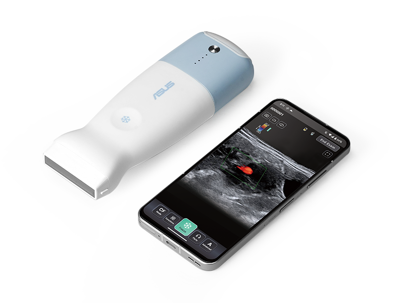 The four main features of ASUS Handheld Ultrasound LU800 for Vet