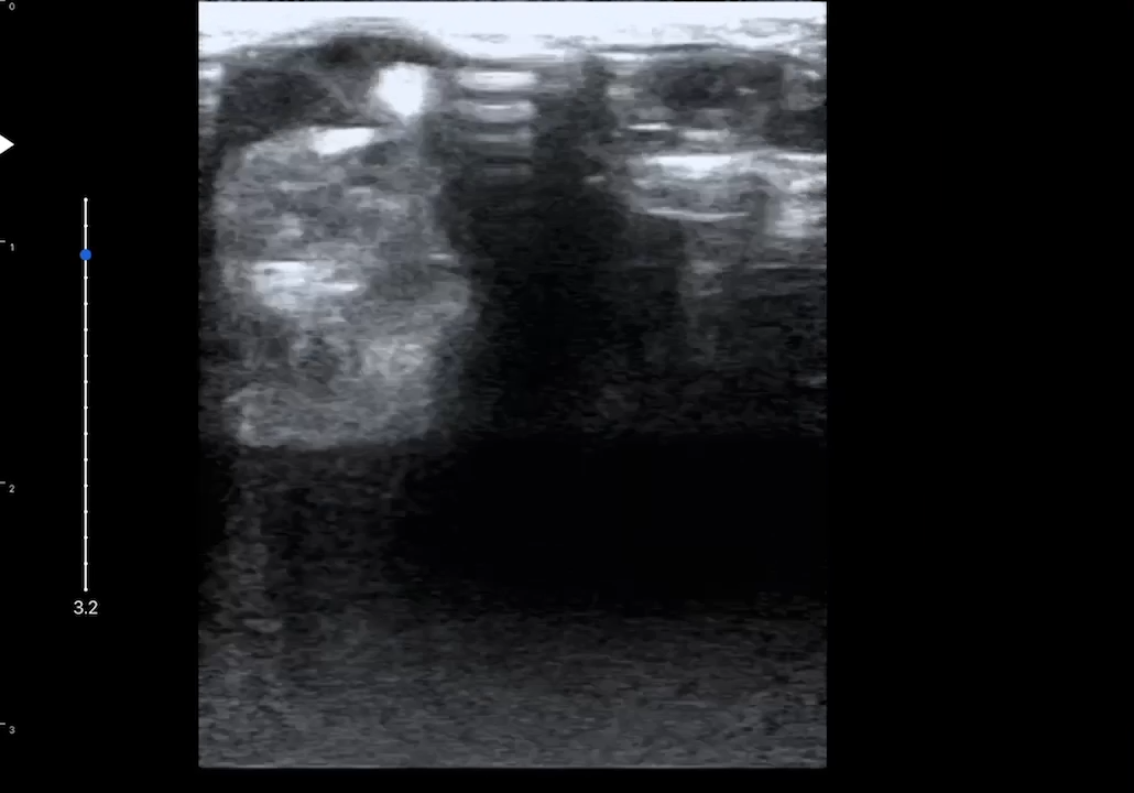 LU800 Canine_Cataract ultrasound image