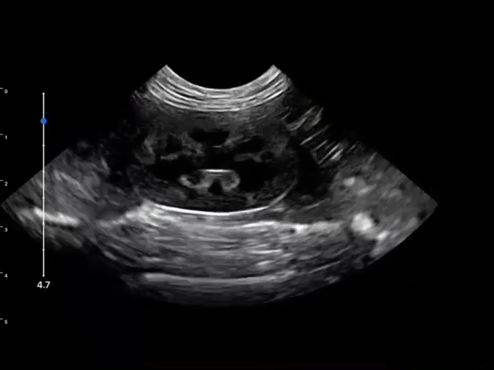LU800 Canine_Kidney ultrasound image