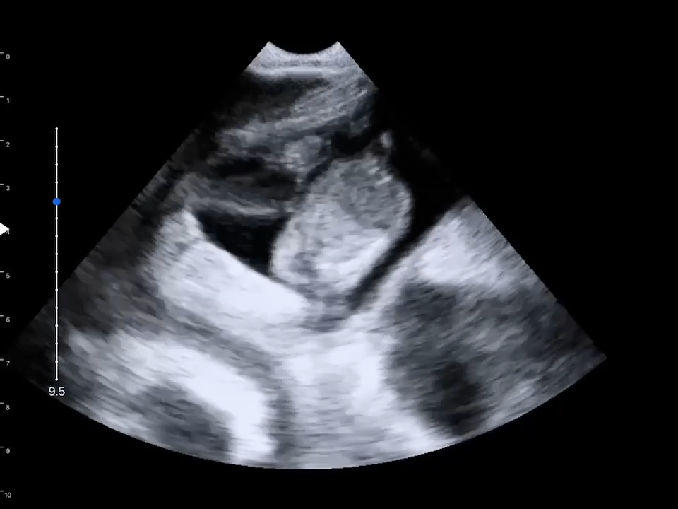 LU800 Canine_Pregnancy ultrasound image