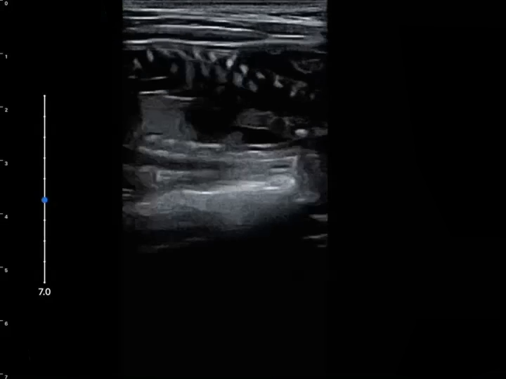 LU800 Canine_Pregnant 54 days ultrasound image