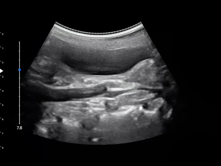 LU800 Canine_Pyometra ultrasound image