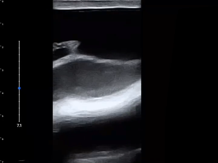 LU800 Canine_Scrotal Trauma(Intra0testicular hematoma) ultrasound image
