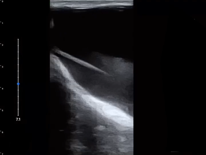 LU800 Canine_Scrotal Trauma(Intra0testicular hematoma)_2 ultrasound image