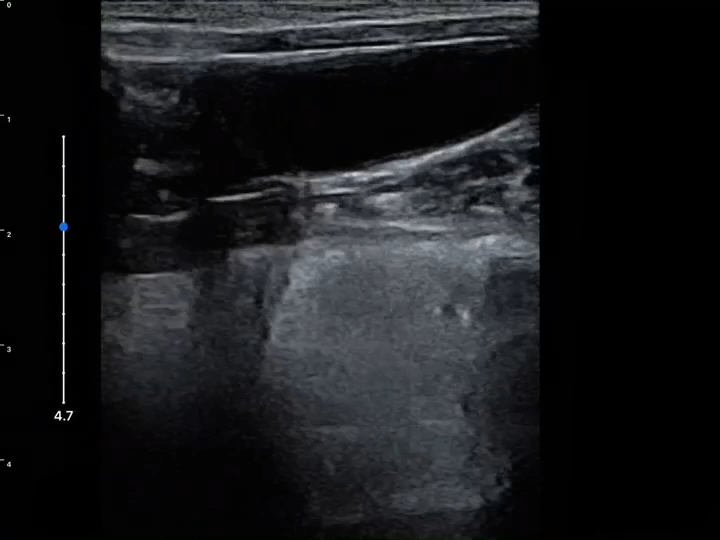 LU800 Chihuahua_Pyometra ultrasound image