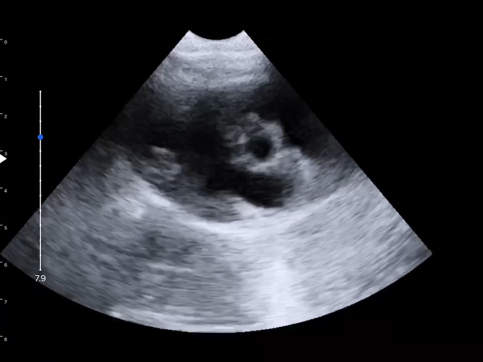 LU800 Chihuahua_cardiac_B mode ultrasound image