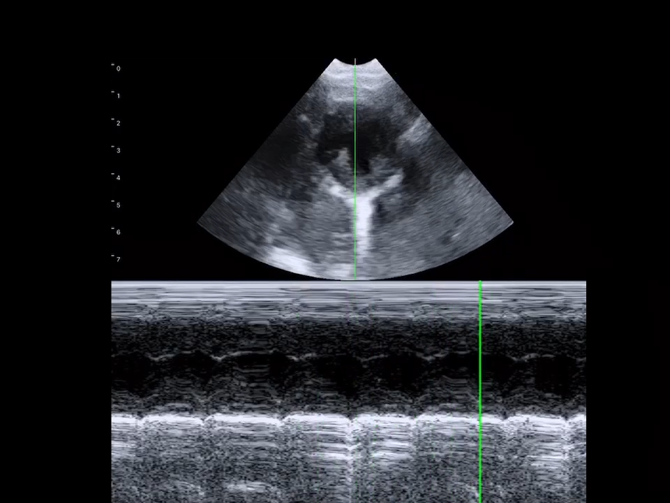 LU800 Chihuahua_cardiac_M mode ultrasound image