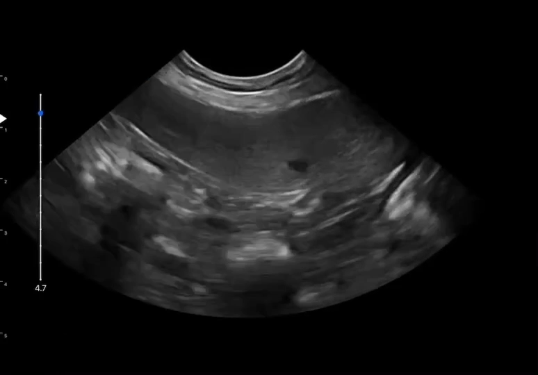 LU800 Jack Russell Terrier_Liver ultrasound image