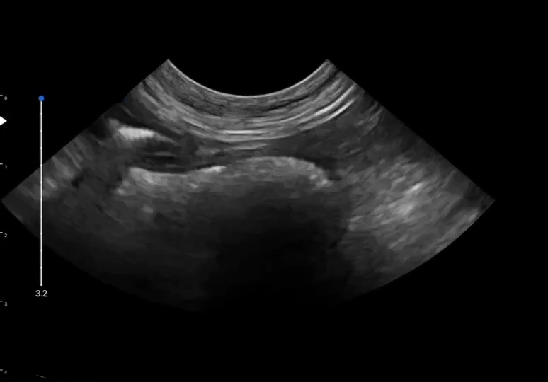 LU800 Jack Russell Terrier_Stomach ultrasound image