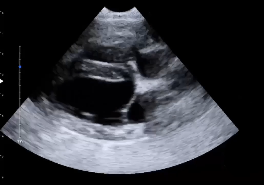LU800 Jack Russell Terrier_cardiac_B mode ultrasound image