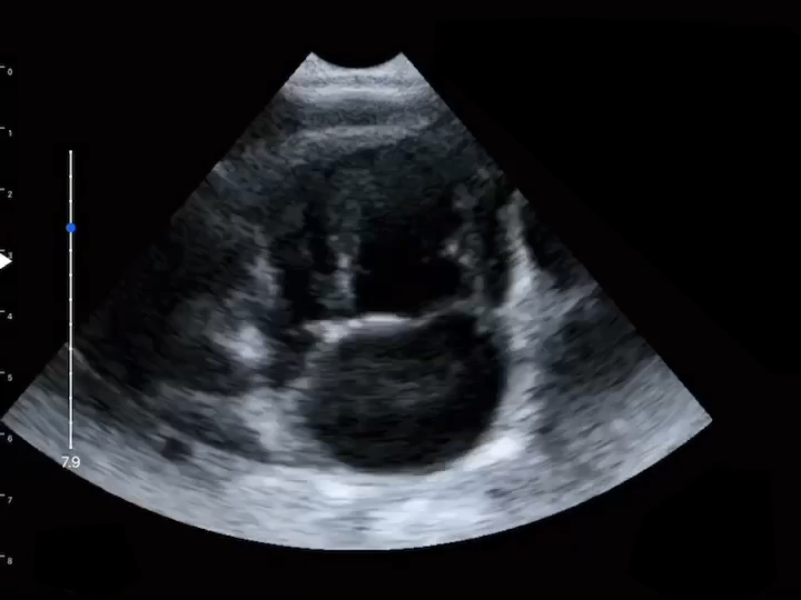 LU800 Maltese_Mitral Regurgitation_Left Atrial Ventricular Dilation_B mode ultrasound image