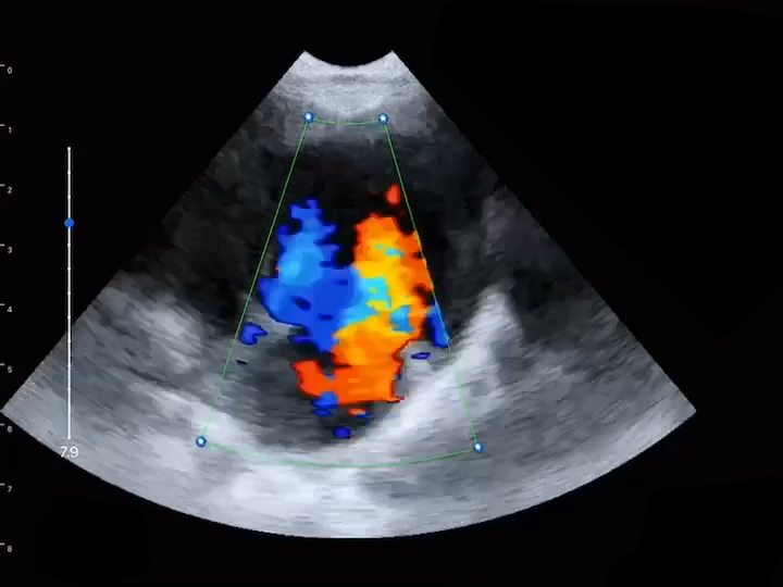 LU800 Maltese_Mitral Regurgitation_Left Atrial Ventricular Dilation_CF mode ultrasound image