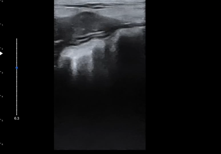 LU800 Poodle_Intestines ultrasound image
