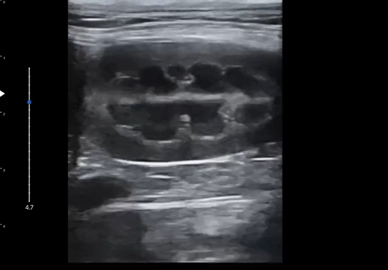 LU800 Poodle_Kidney ultrasound image