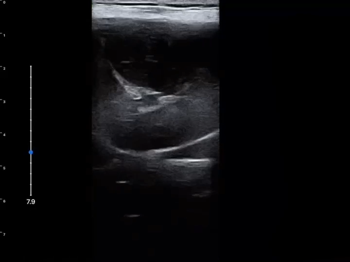 LU800 Poodle_Pancreatitis ultrasound image