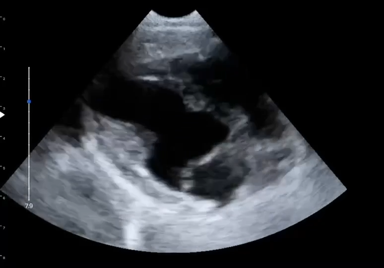 LU800 Schnauzer_cardiac_B mode ultrasound image