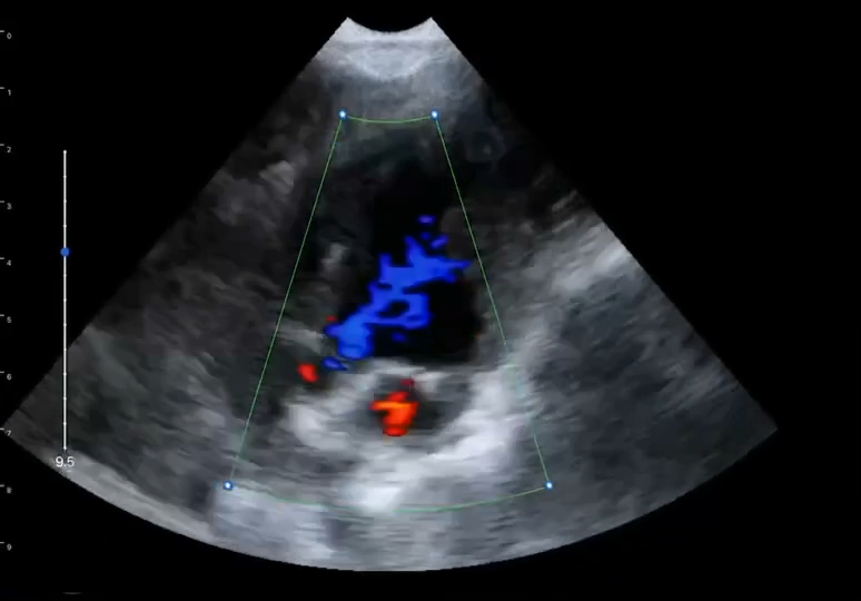 LU800 Schnauzer_cardiac_CF mode ultrasound image