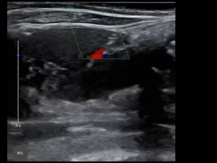 LU800 Hedgehog_abdomen ultrasound image