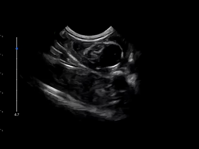 LU800 Meerkat_Pregnancy ultrasound image