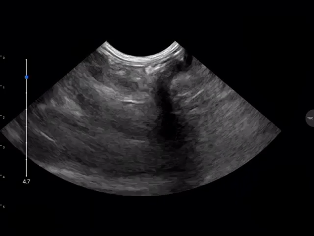 LU800 Meerkat_Pregnancy_2 ultrasound image