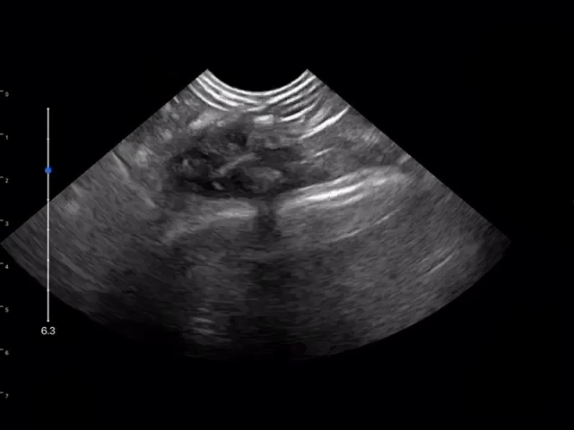 LU800 Meerkat_Pregnancy_3 ultrasound image