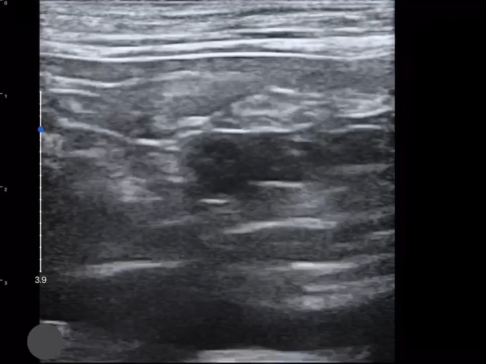 LU800 Feline_Abdominal ultrasound image