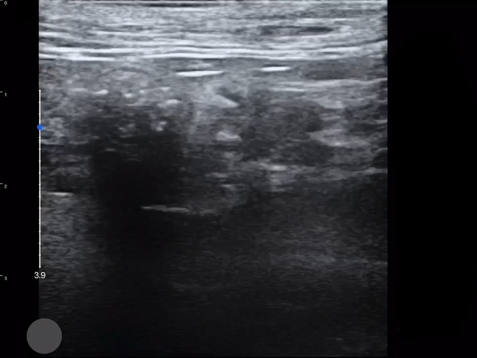 LU800 Feline_Abdominal_2 ultrasound image