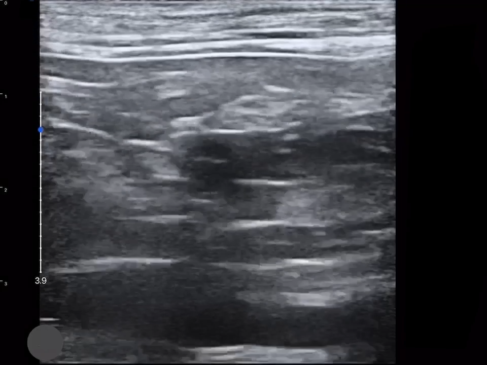 LU800 Feline_Abdominal_4 ultrasound image