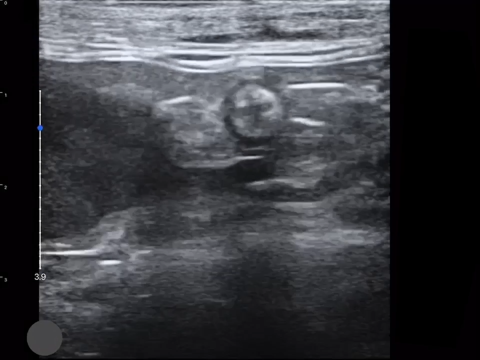 LU800 Feline_Abdominal_5 ultrasound image
