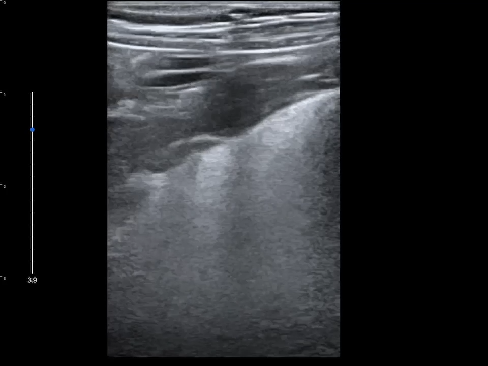 LU800 Feline_Gastrointestinal tract ultrasound image