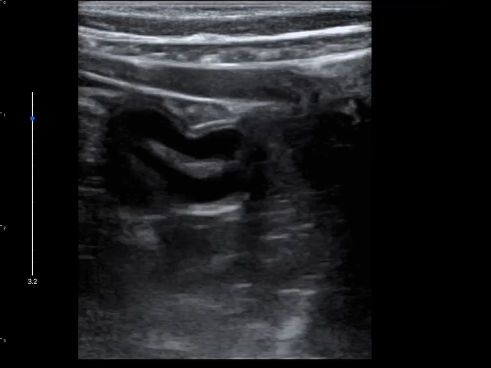 LU800 Feline_Gastrointestinal tract_2 ultrasound image