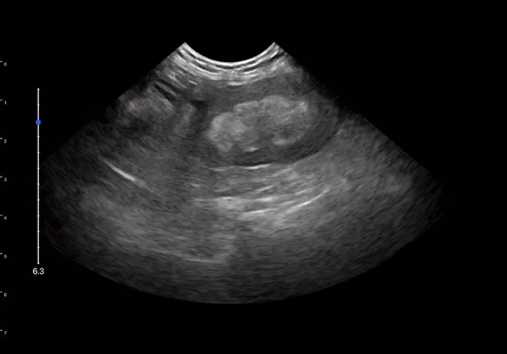 LU800 Feline_Kidney_Hydronephrosis ultrasound image