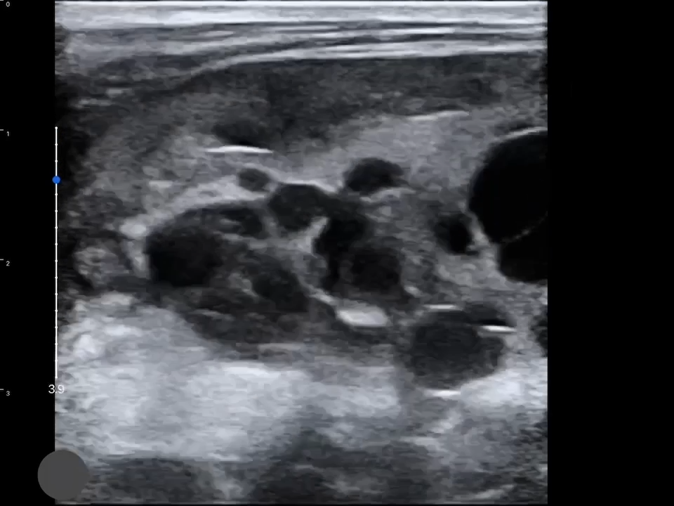 LU800 Feline_Kidney_Polycystic Kidney Disease ultrasound image
