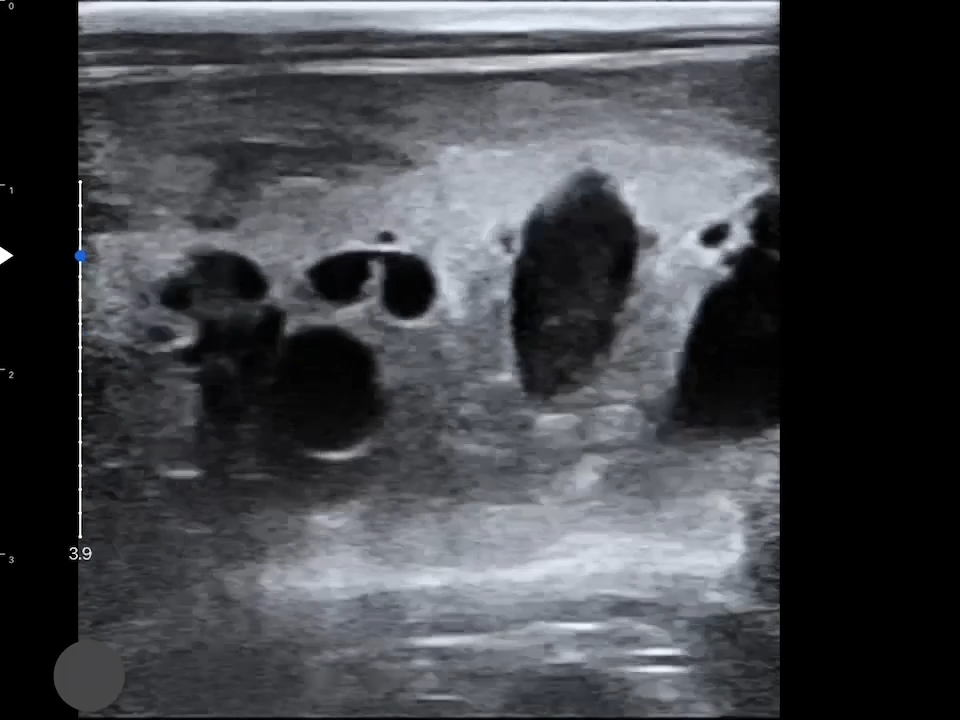 LU800 Feline_Kidney_Polycystic Kidney Disease_3 ultrasound image