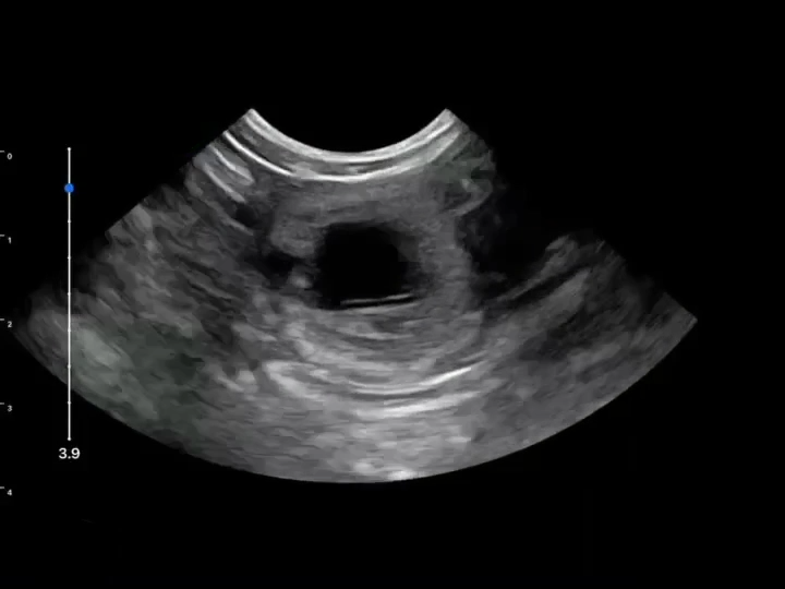 LU800 Feline_Pregnant 32 days ultrasound image