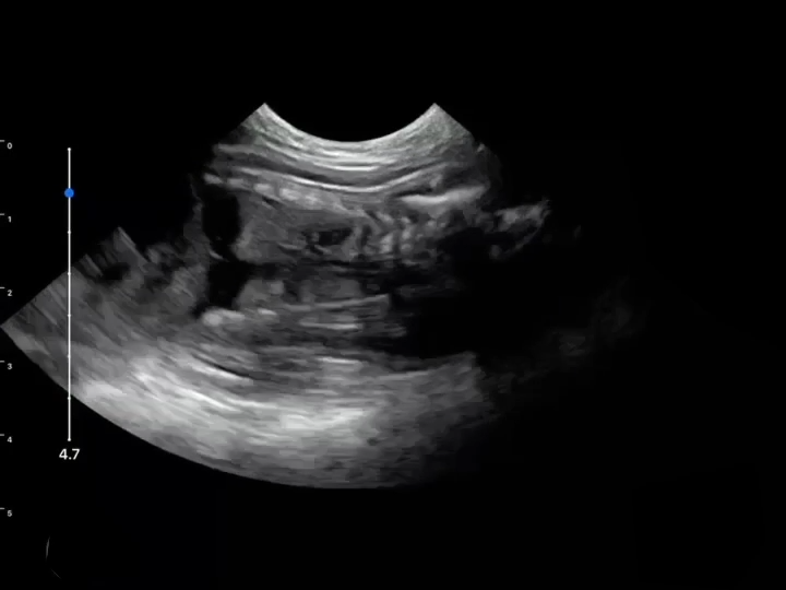 LU800 Feline_Pregnant 52 days ultrasound image