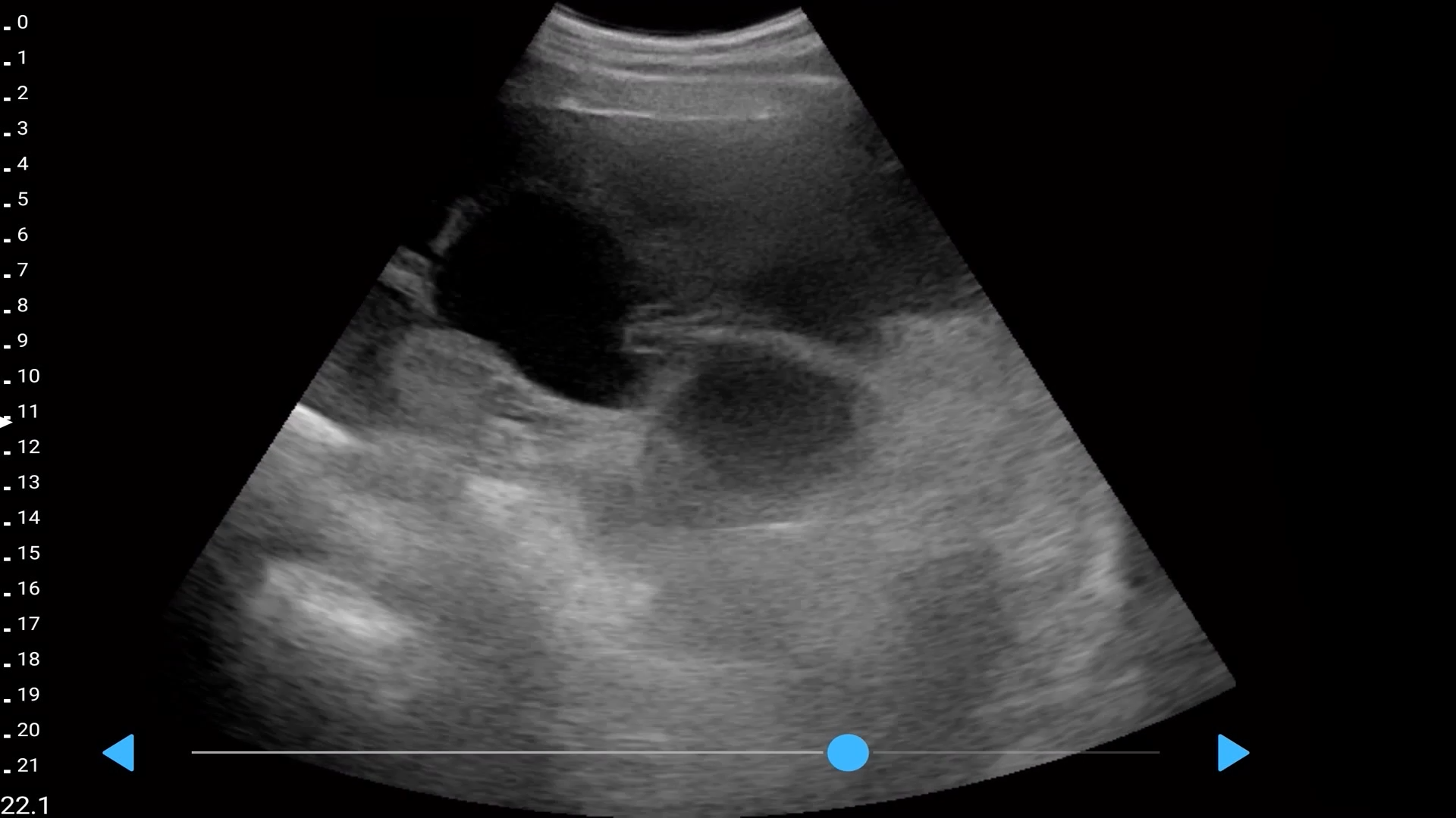 LU800 Swine_Porcine embryo ultrasound image