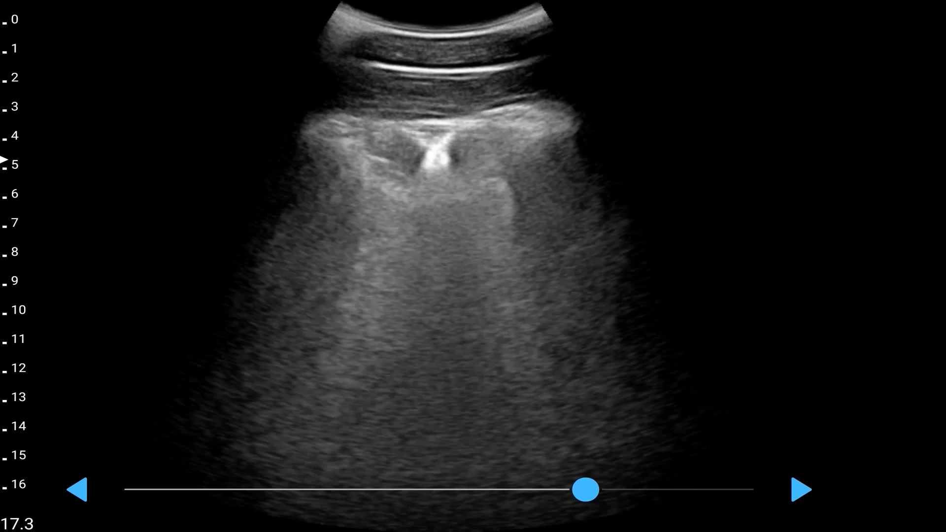 LU800 Swine_Porcine lard measurement ultrasound image